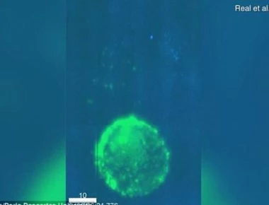 Πως ένα κύτταρο μολυσμένο με HIV προσβάλλει υγιή οργανισμό κατά τη διάρκεια της επαφής (βίντεο)